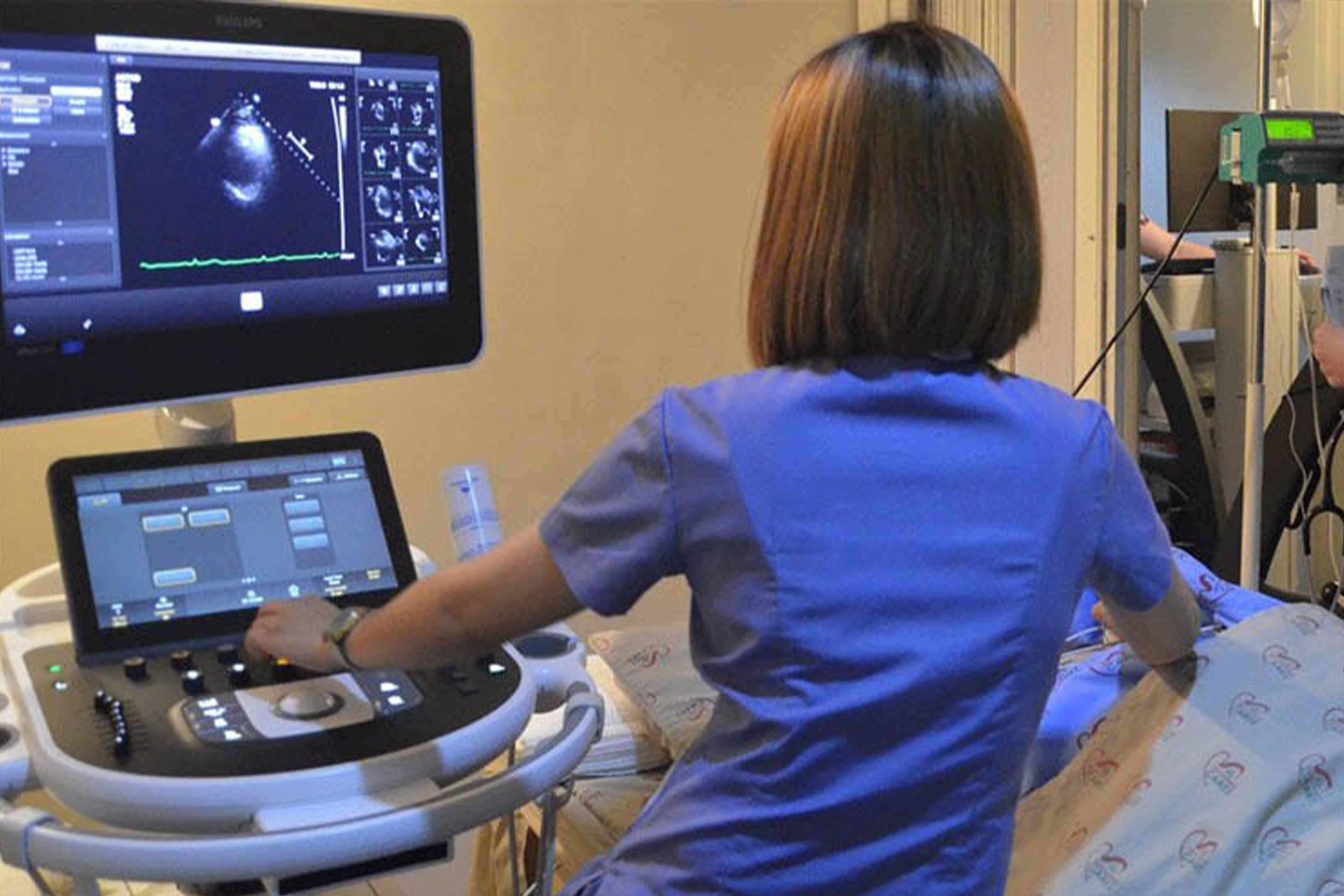 2D Echocardiography with Colour Doppler