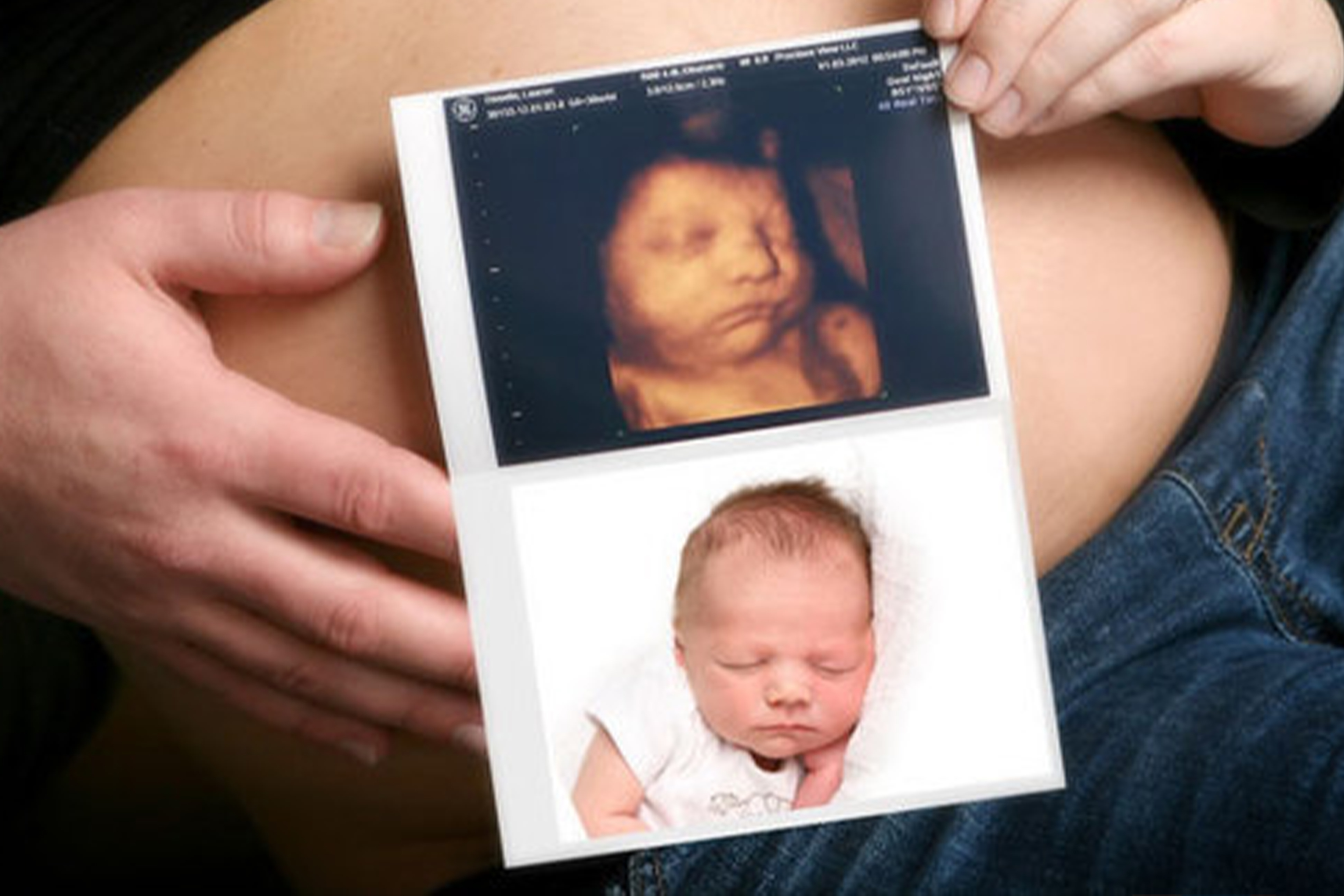 3d-4d-sonography